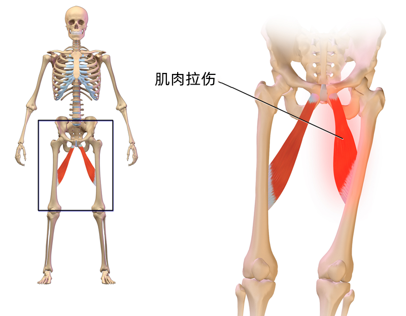 大腿根部位置示意图图片