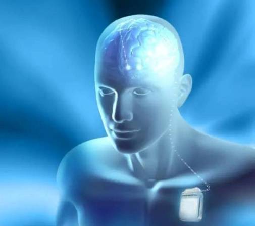 华山医院神经外科胡杰教授带你认识癫痫脑起搏器治疗