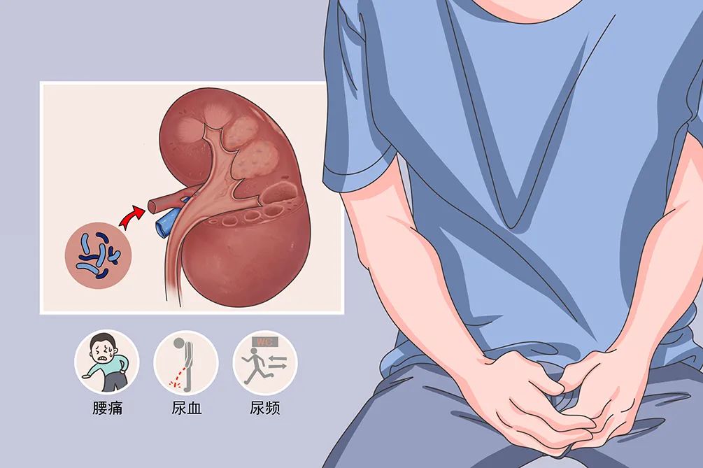 肾脏位置疼图片