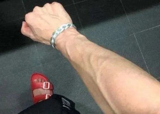 为什么有些人手臂青筋很突出？提醒：有这6个原因