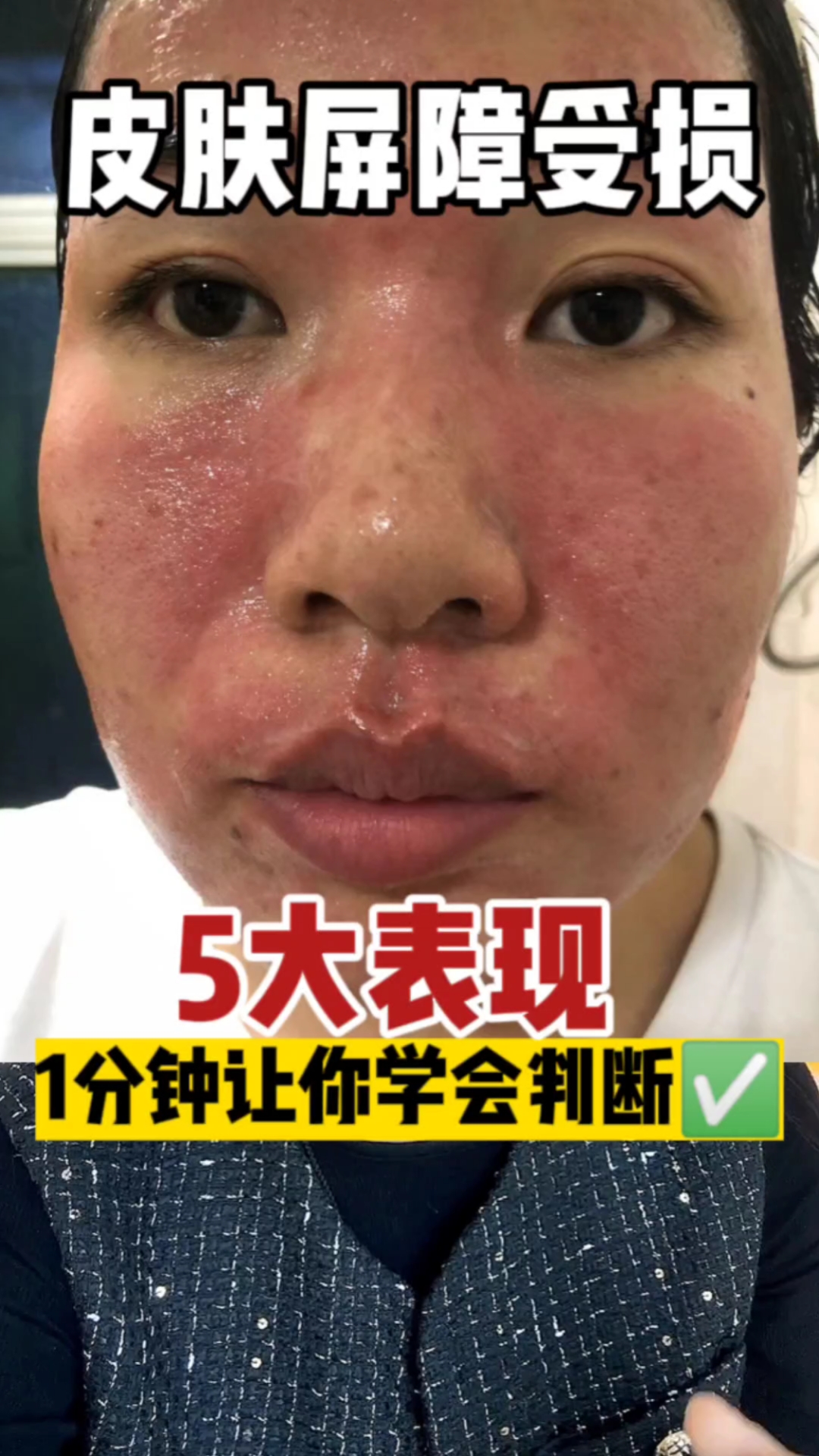 10重度屏障受损经验总结!全是细节!