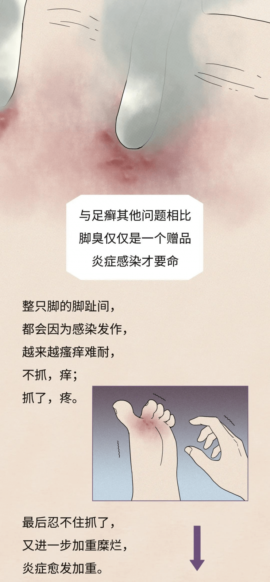 为什么你的"脚丫子"会那么"臭?