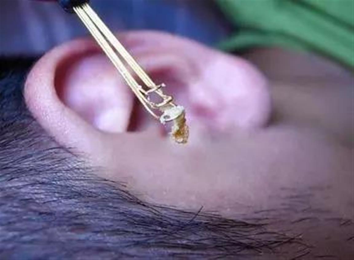 油耳朵内部图片图片
