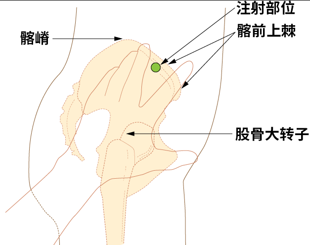 小时候打的"屁股针",为什么现在越来越少见了?