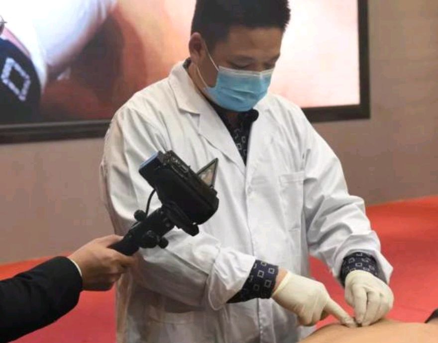 名医高雨,自创"高雨针刀",临床经验丰富,当之无愧的针刀之神