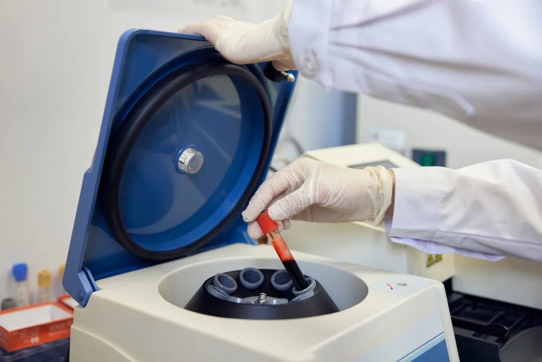 新鲜冰冻血浆与普通冰冻血浆有何不同?