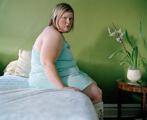 肥胖症图片中年人图片