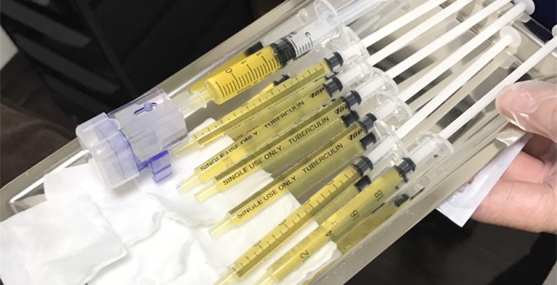 求助:干细胞可面部抗衰吗,干细胞美容针可以打吗?