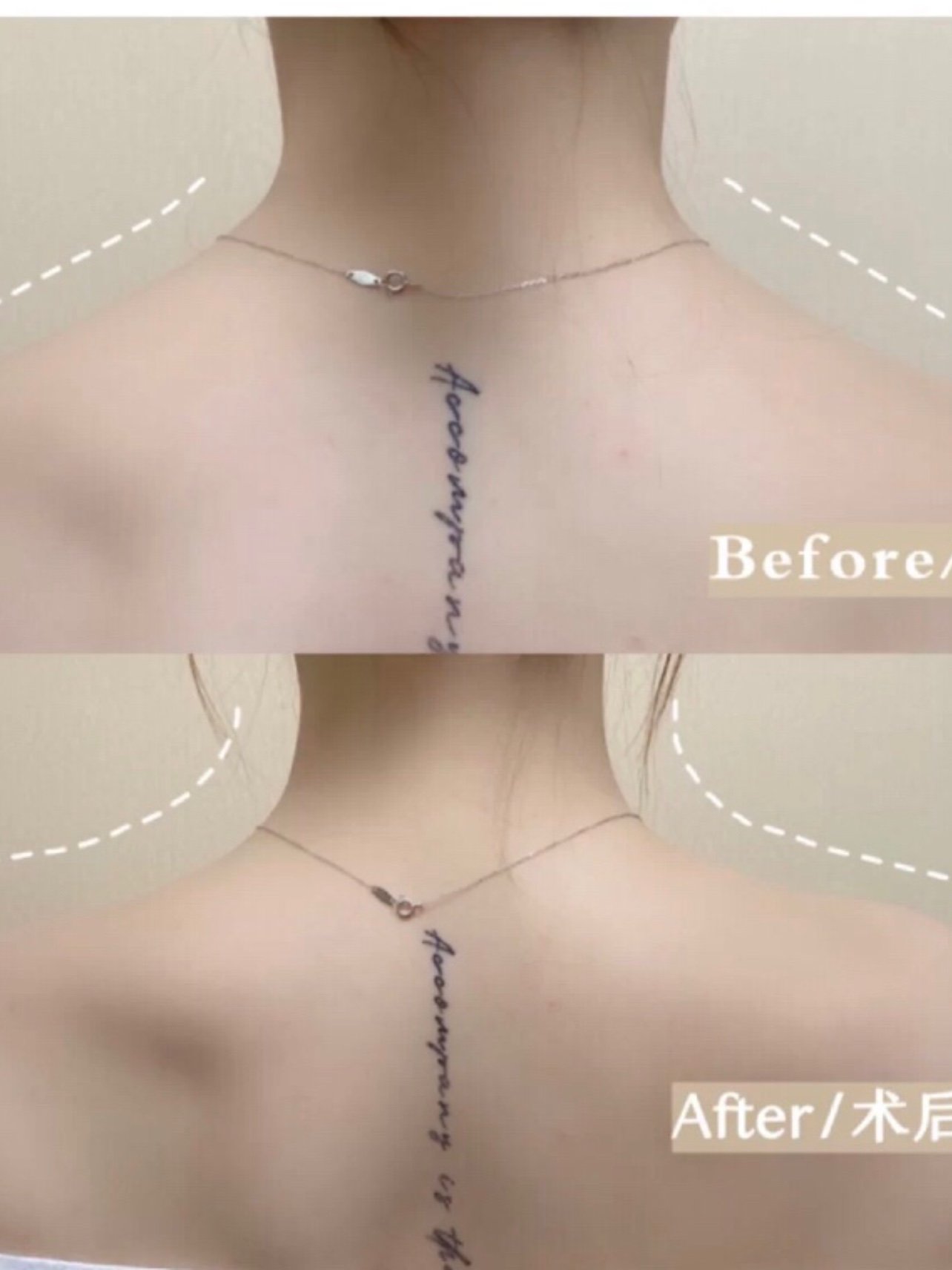 夏季适合做的医美项目有哪些?夏季护肤需要注意哪几点呢?