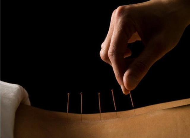 国医大师程莘农:用小小银针救治过数万人,挂号费30年始终是1元