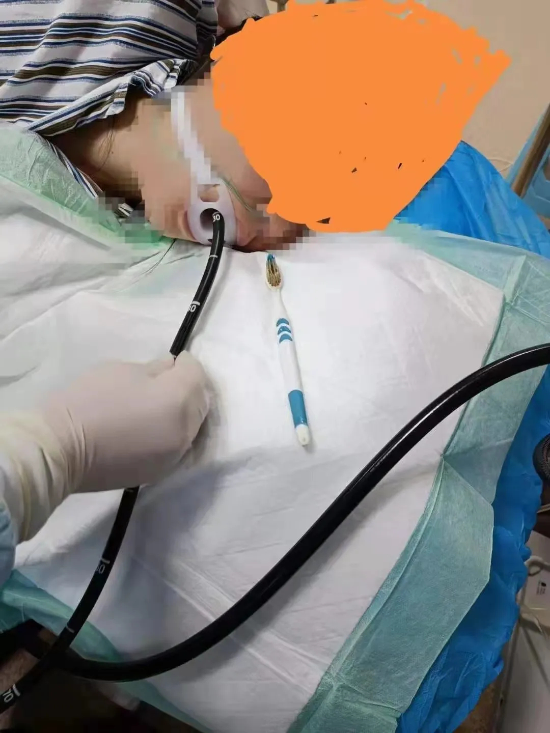 崩溃!江苏一女子误吞整个牙刷,只因刷牙时听了个笑话