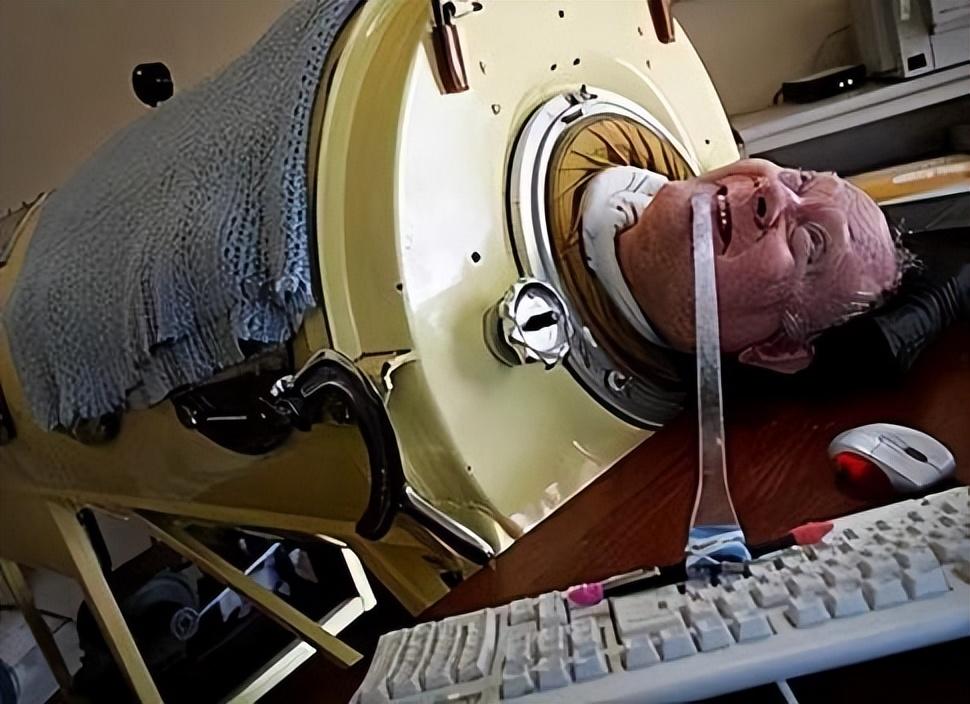 "铁肺人"保罗,一个困在铁桶里69年的男人