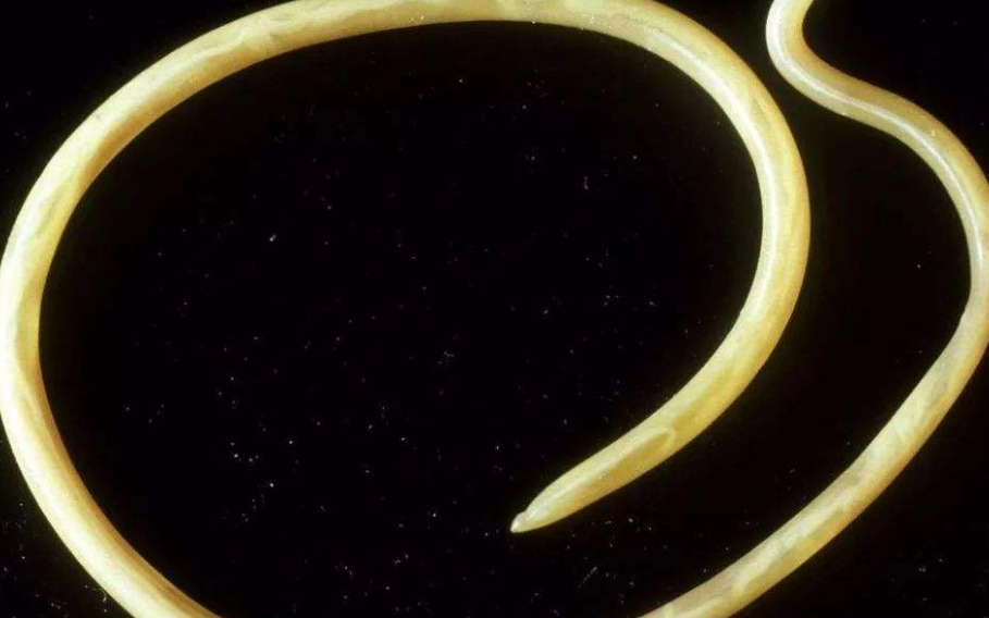 蛔虫病是传染性疾病,主要通过口服驱虫药治疗,少数情况需手术