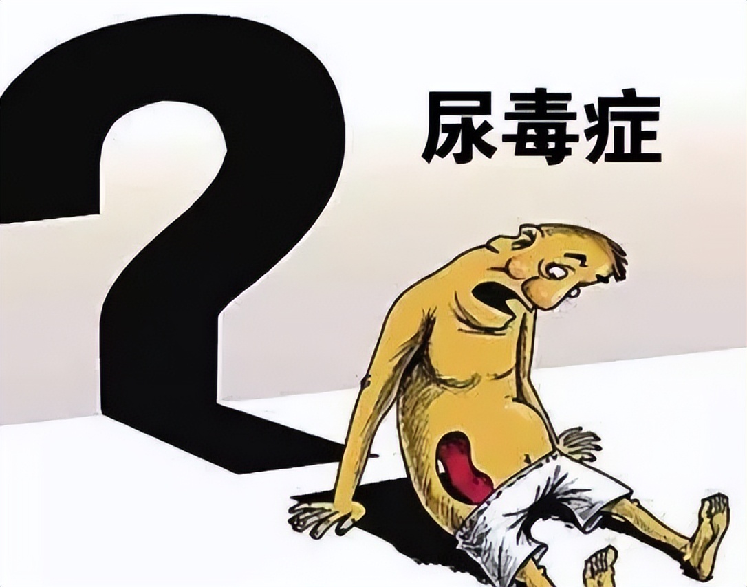 为什么"尿毒症"越来越多?7种行为可能会伤肾,尽量少做