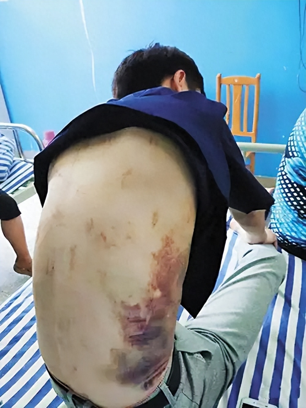 被割腰子男子找工作被骗缅甸父亲寻找人被告知已遭杀害