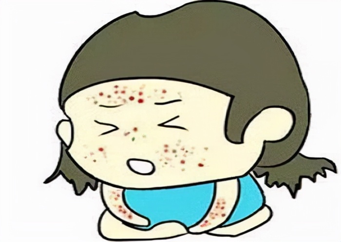 肌痹,属于五体痹之一,与外感风寒湿,饮食不节,劳倦过度等有关