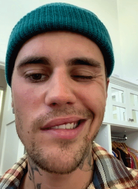 比伯惊爆患上罕见病!