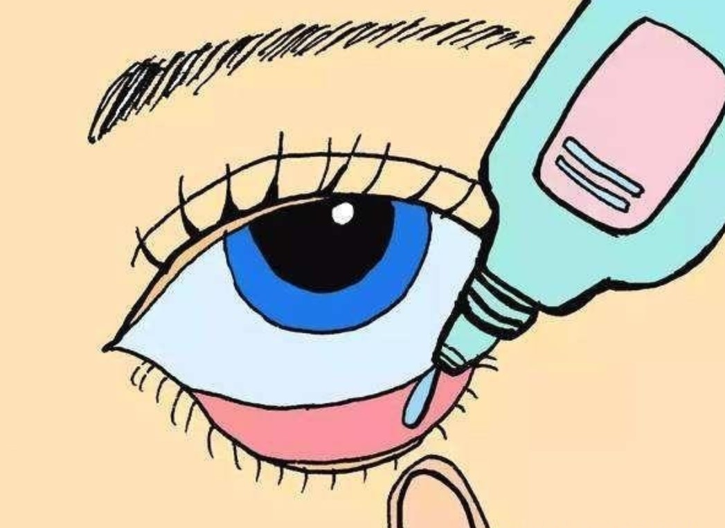 伴有虹膜睫状体炎的继发性青光眼,不会遗传,可导致视力下降