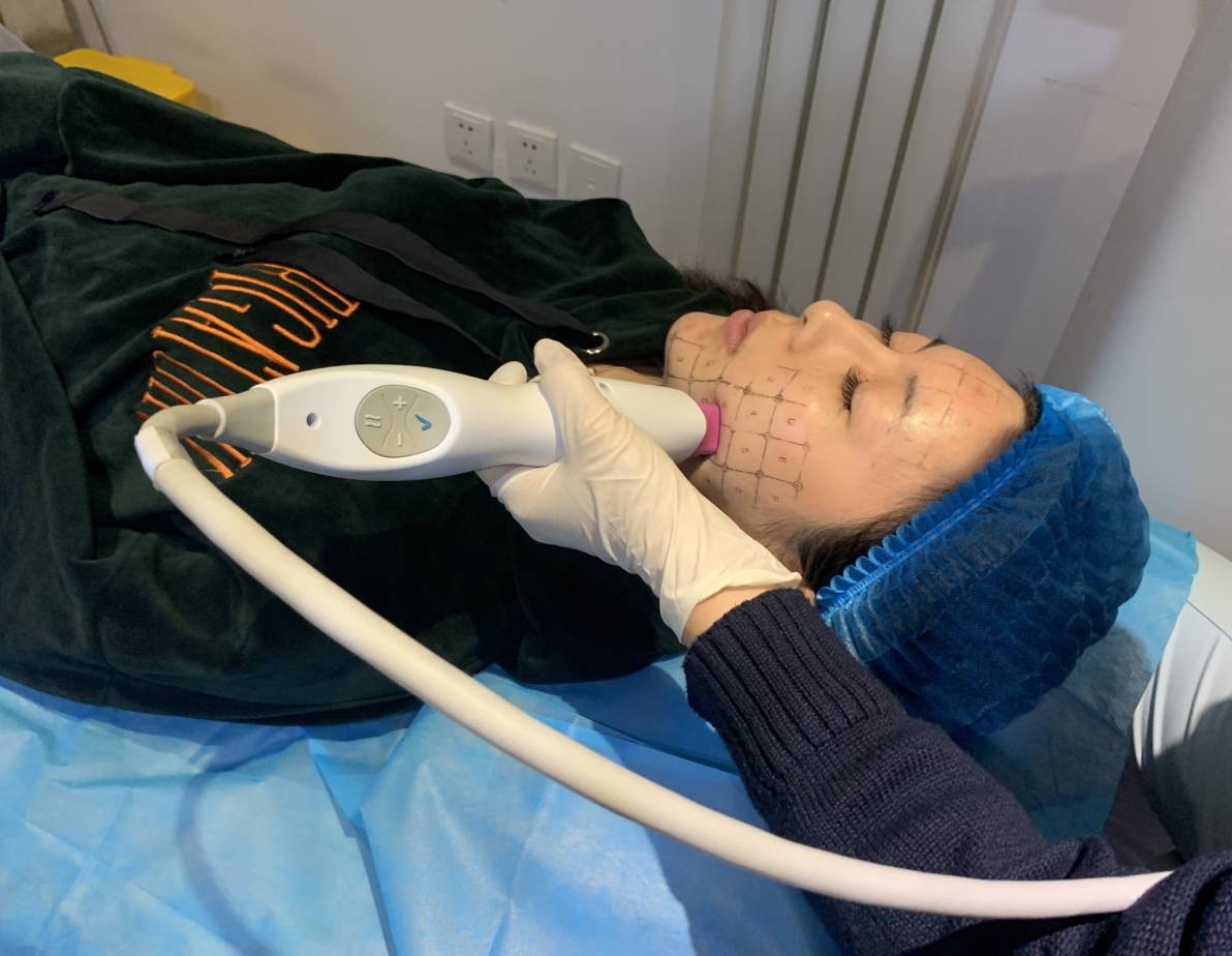 热玛吉手术有什么风险,优点是什么?要注意治疗后的护理事项