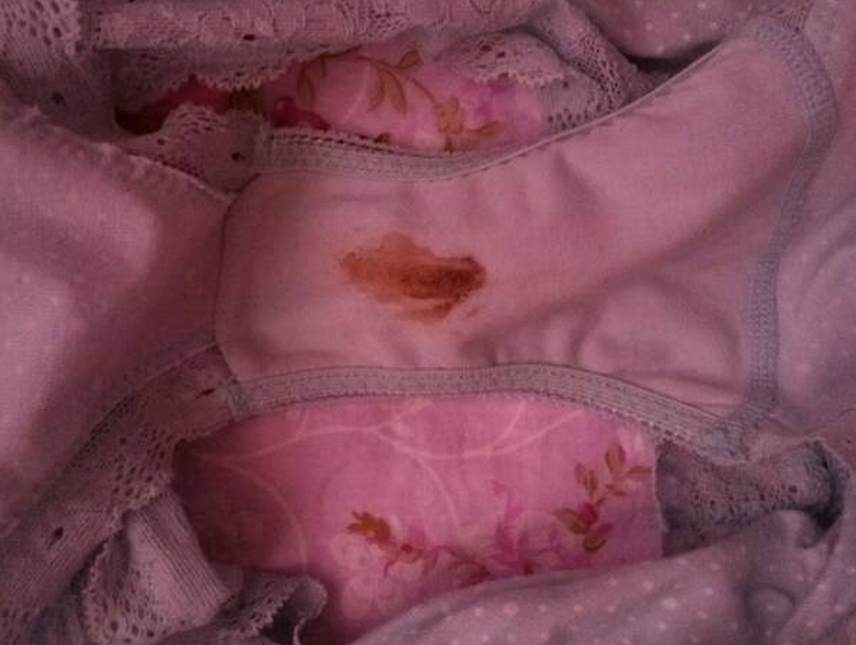 昨天她洗完澡后,我给她洗内裤时惊讶地发现了一点点血迹.