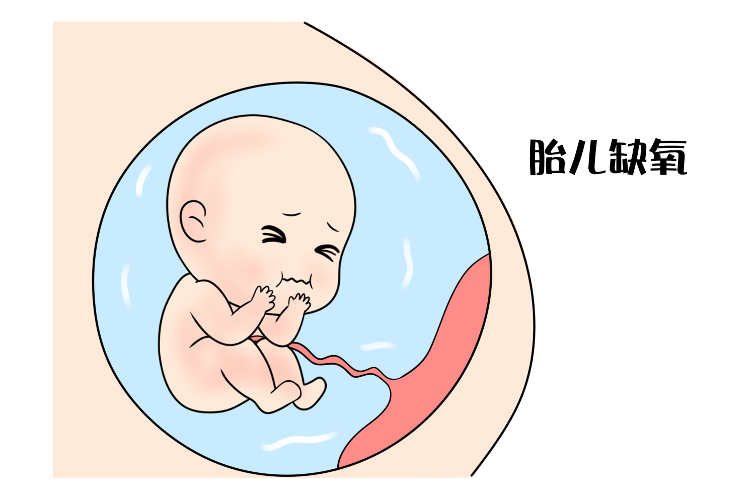 孕期长期左侧卧,胎宝总是拳打脚踢抗议,也许是在求救