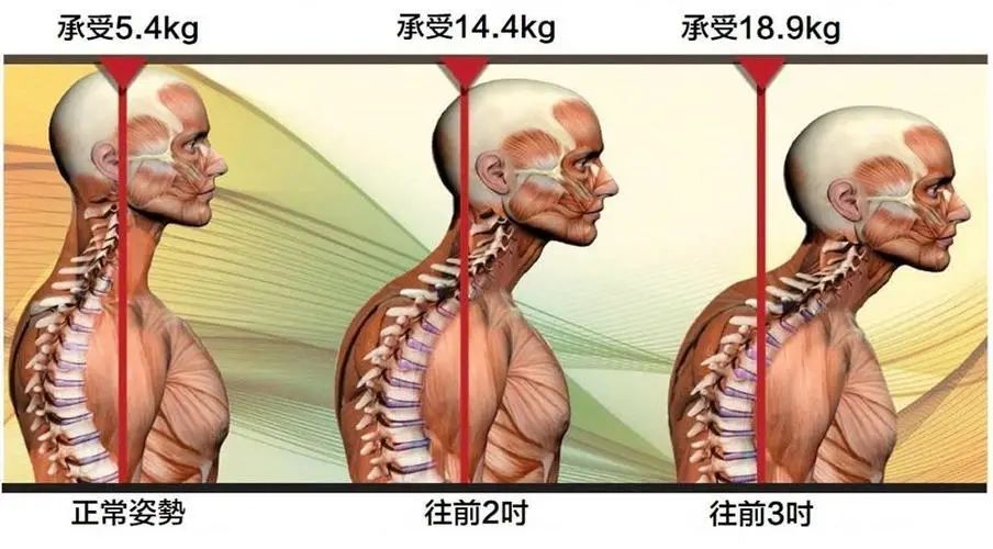 折磨几个月颈椎病终于治好了 只因用了这个方法