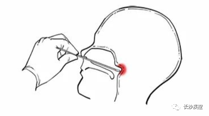 核酸采集咽部示意图图片