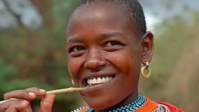 非洲人除了牙齿白,还有一个部位最白,网友:不可思议