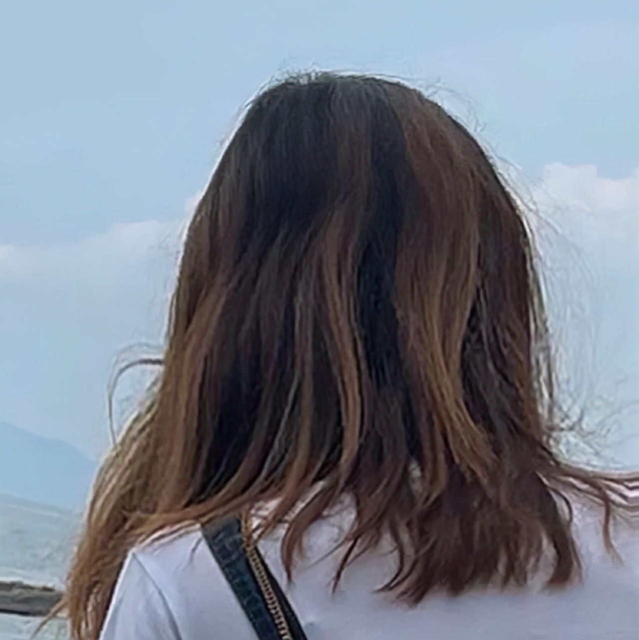 经常扎头发的女生这几个问题很明显发际线后移问题很常见