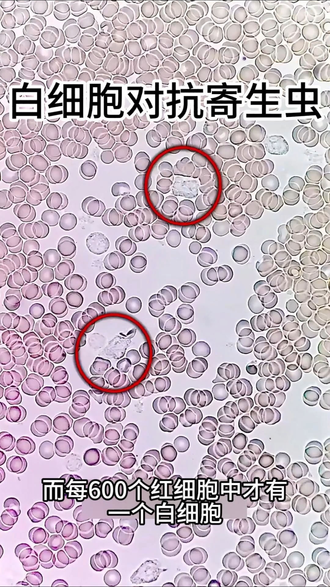 白细胞的作用到底有多大. #科普 #白细胞 #白细胞吞噬细菌