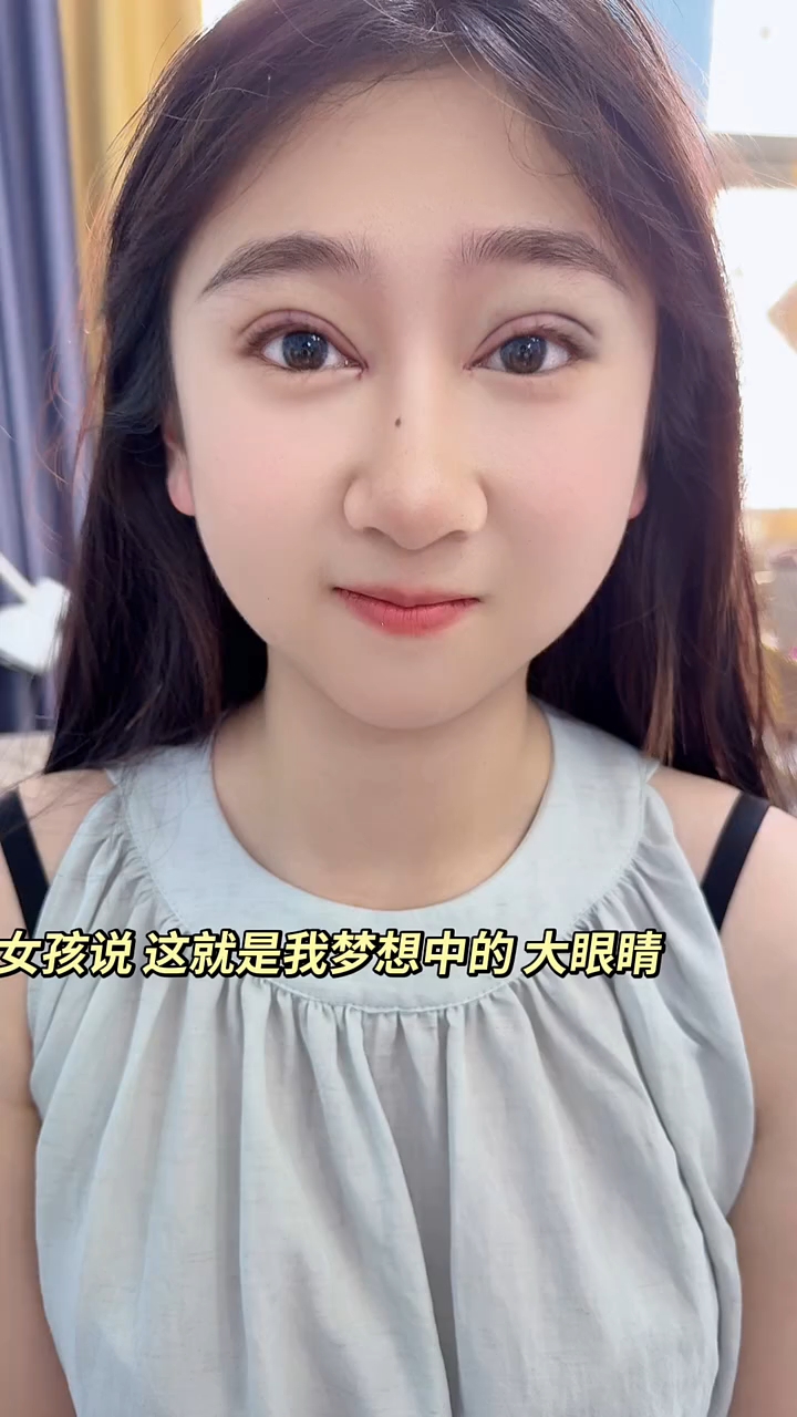 全切双眼皮加开眼角