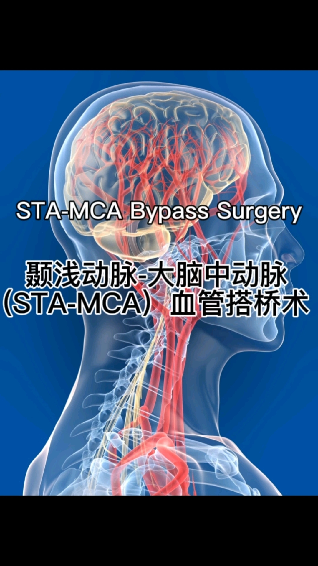 颞浅动脉图片图片