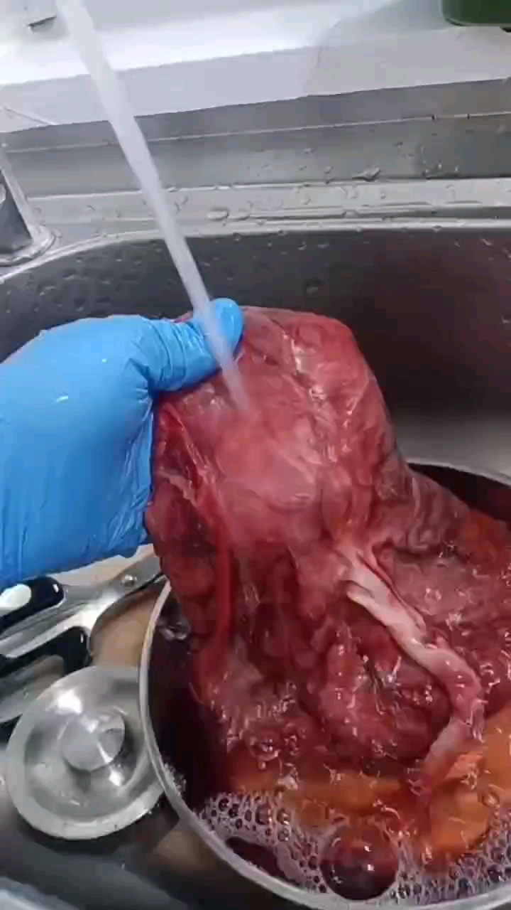 拿到胎盘怎么办?到成都找崔师傅胎盘加工店