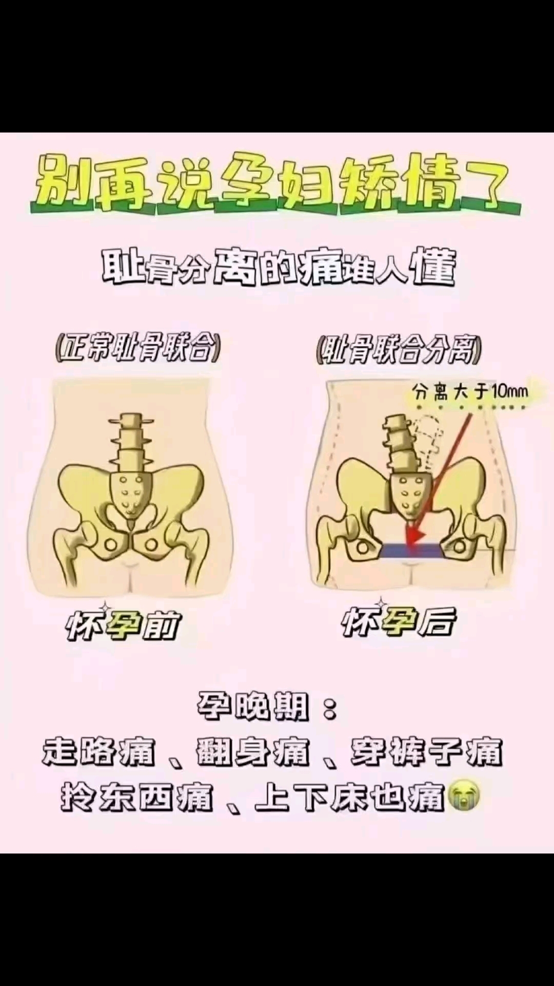 耻骨是什么?女人顺产耻骨会开八到指十,所以盆骨会变大