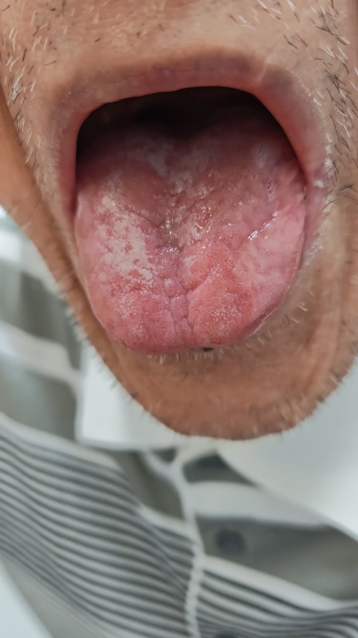 舌嫩苔少脉玄,肾阴亏虚怎调理?