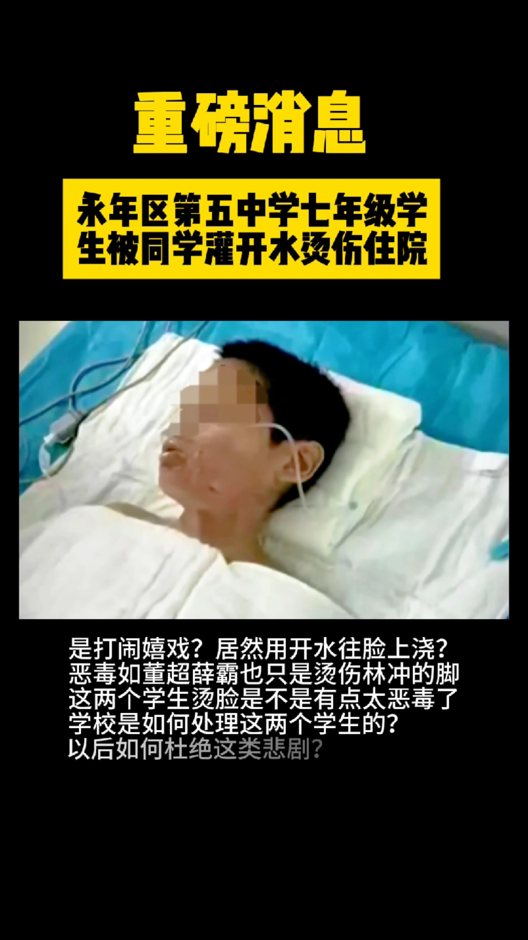 邯郸市永年区第五中学学生被同学灌开水烫伤,这是嬉闹还是霸凌