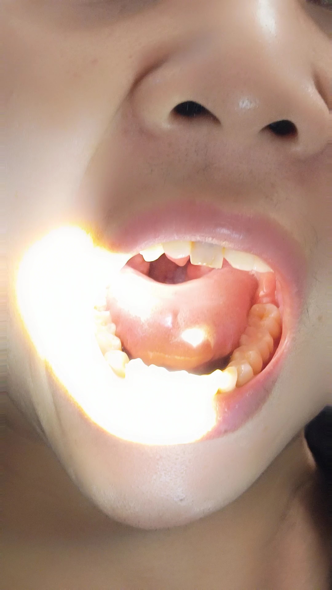 喉咙里长的个什么东西?有谁知道