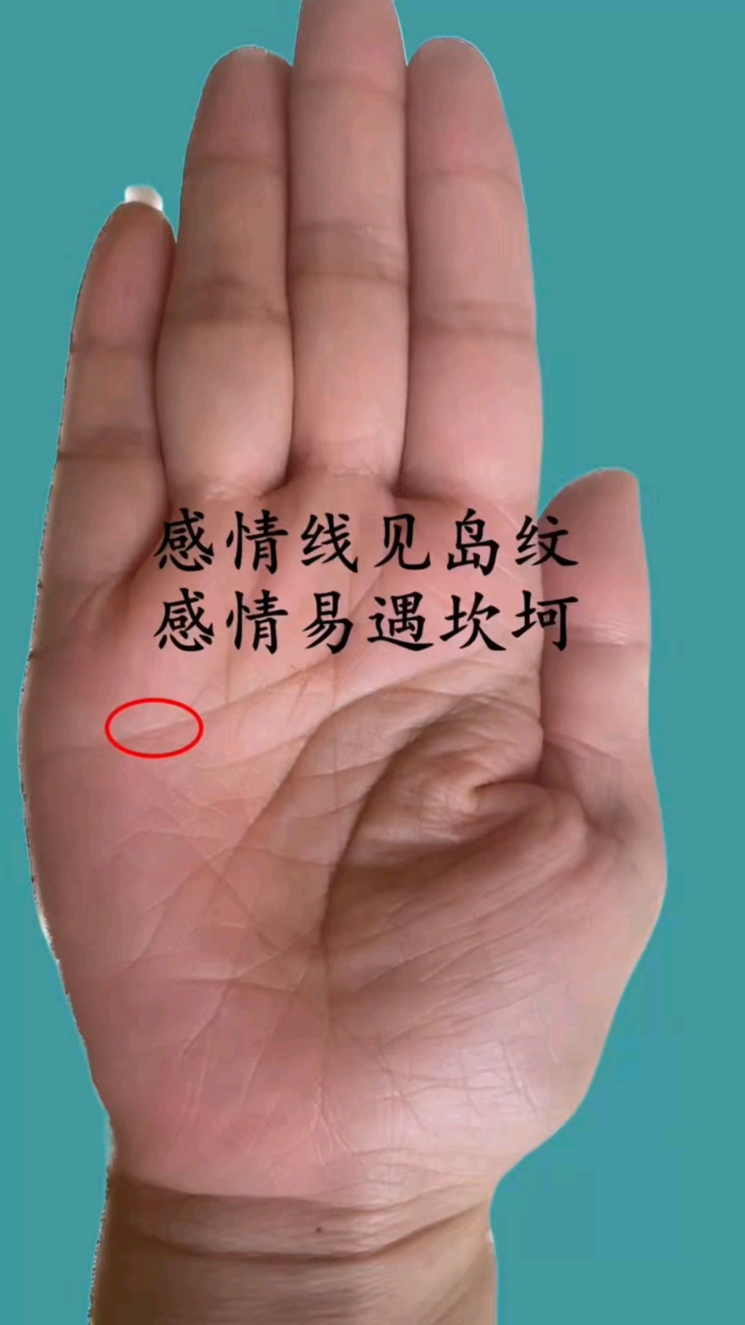 感情纹有岛纹代表着什么