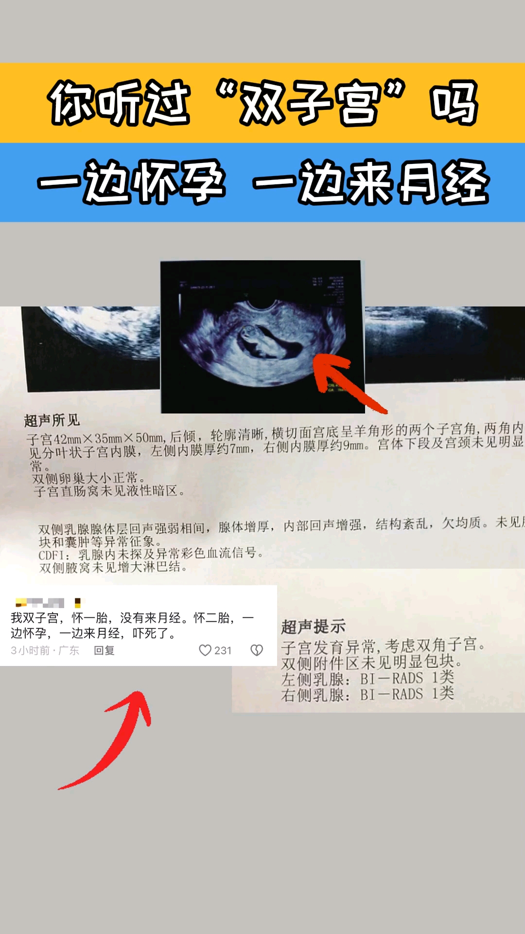 双子宫来例假特点图片