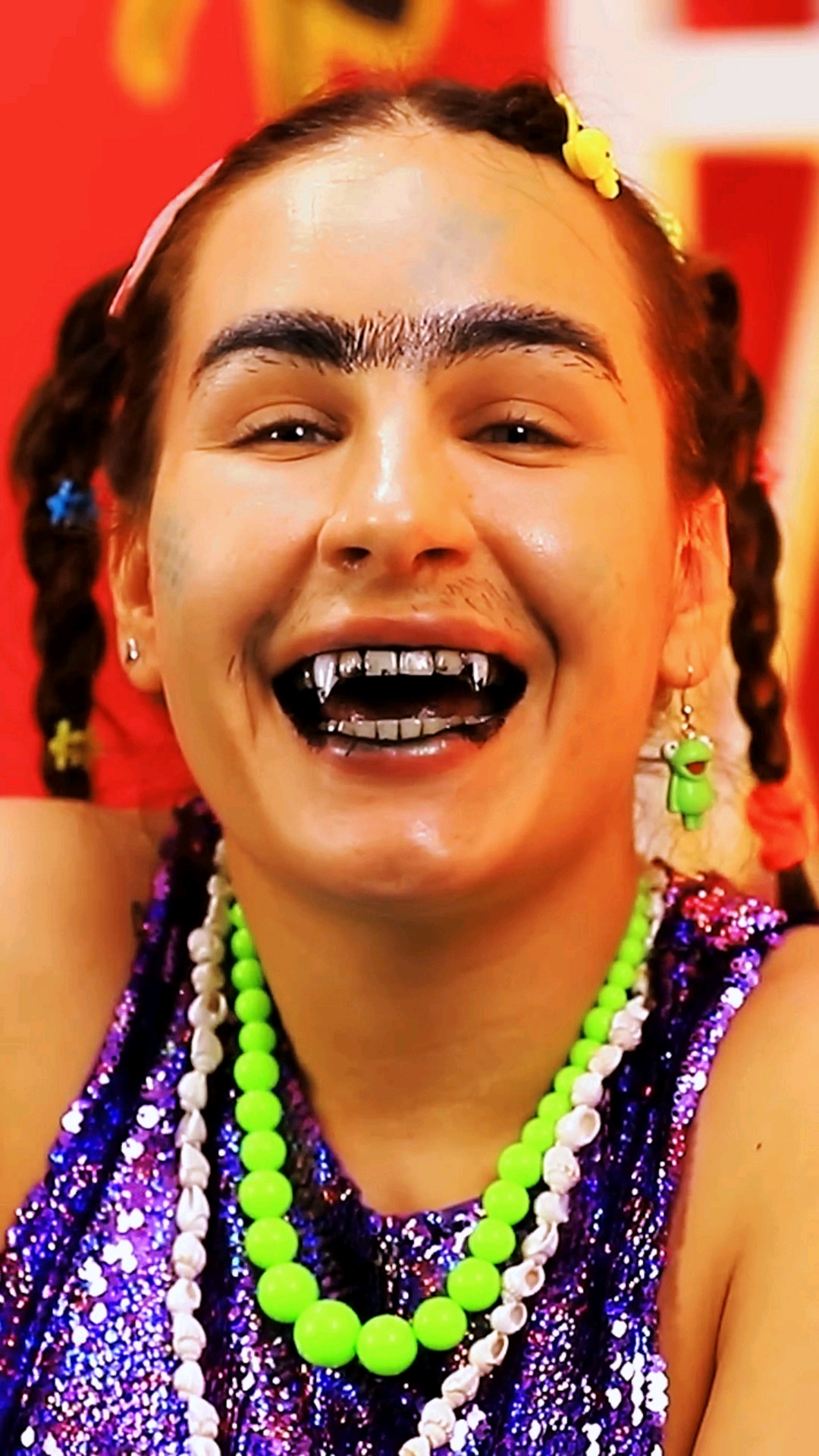 如果你的姐妹牙齿很黑?