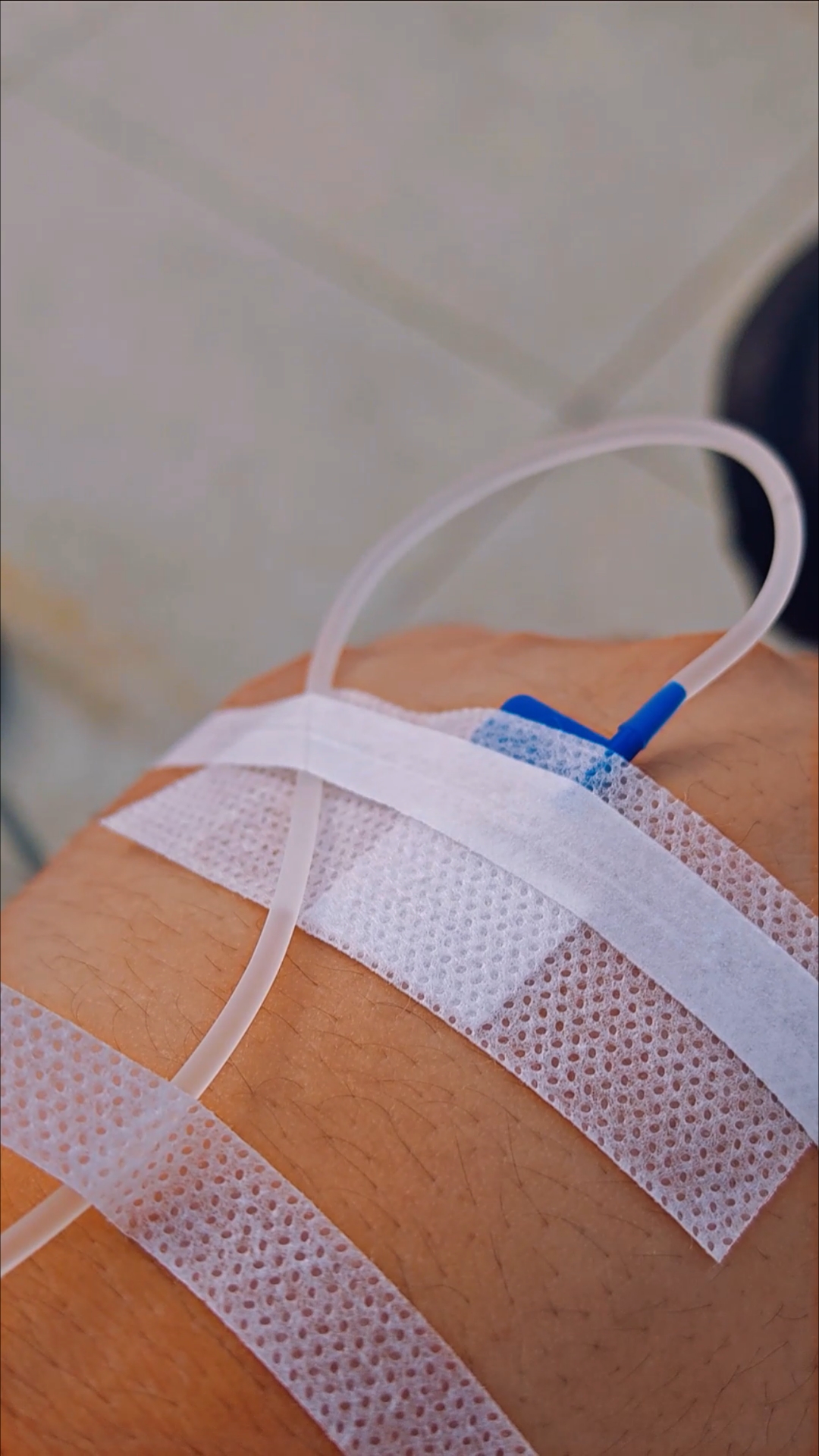 你多久没过打吊瓶了