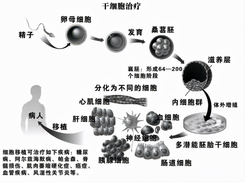 emo了~干细胞注射后的真实感觉