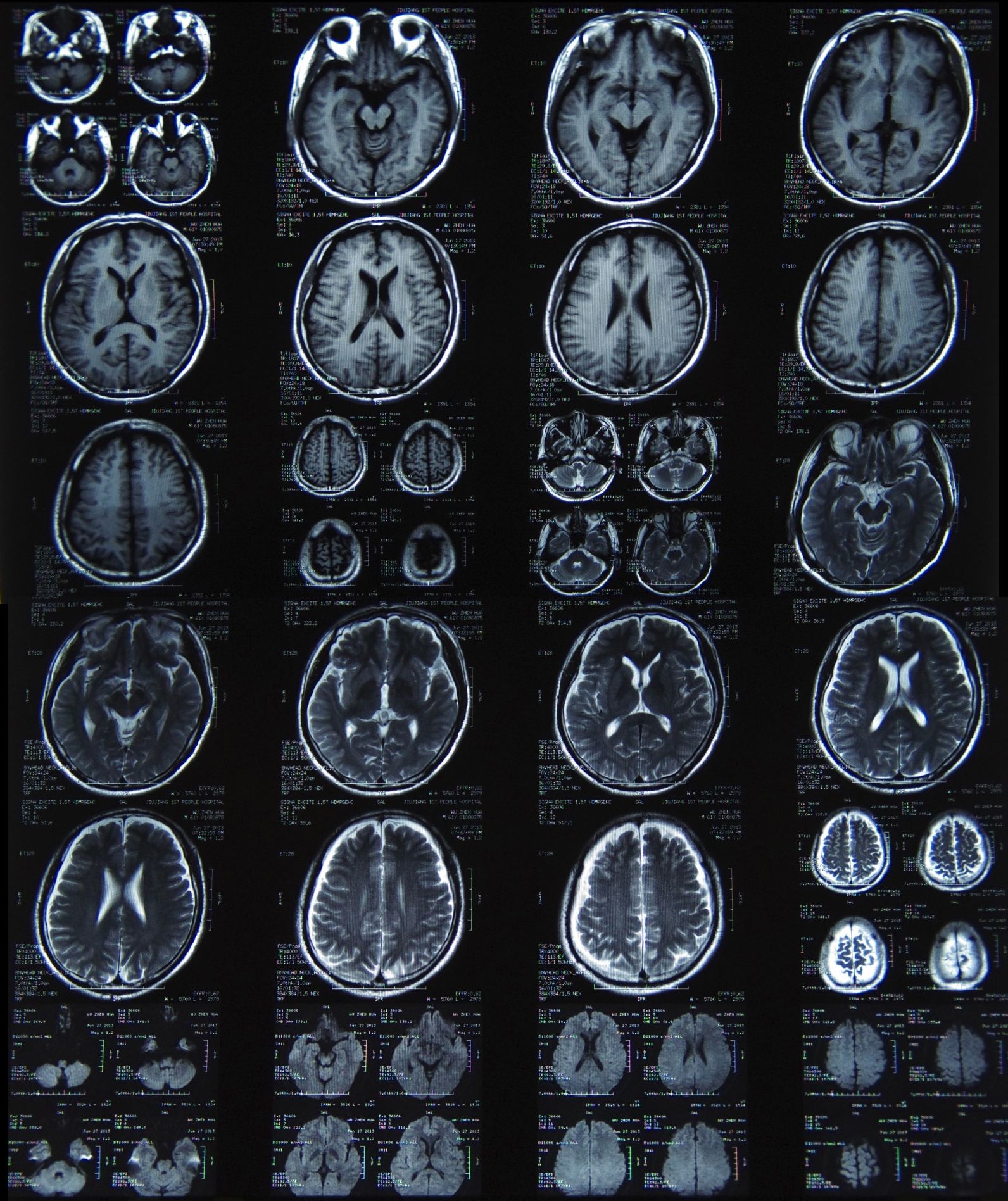 x光,ct,核磁共振有什么区别?三大诊断神器全解析!