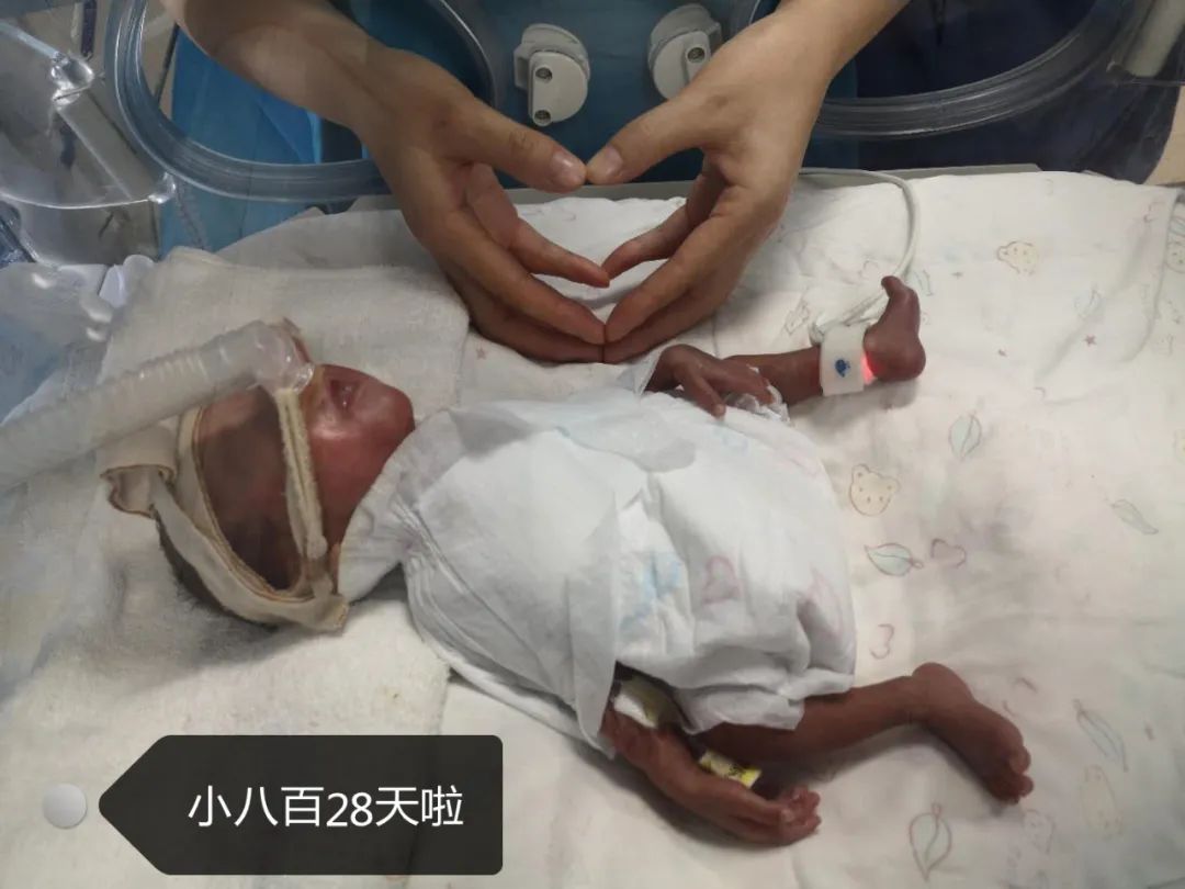 妈妈怀孕6个月产下男婴!医生拍下10张照片,张张让人落泪