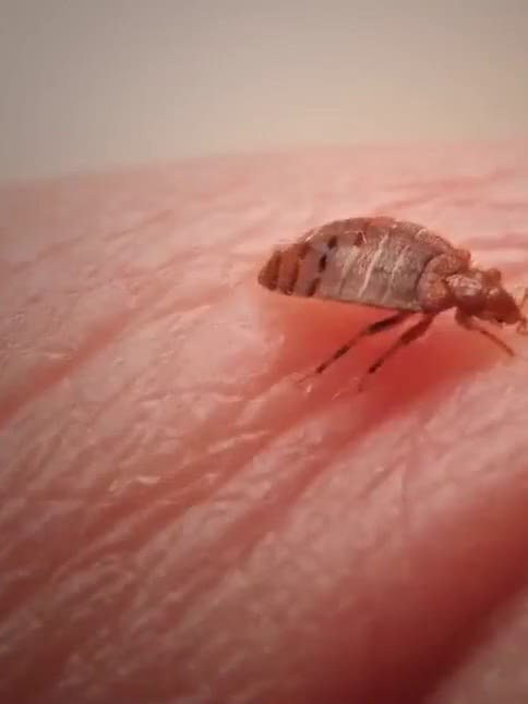 床虱数量激增,吸血时间长达10分钟