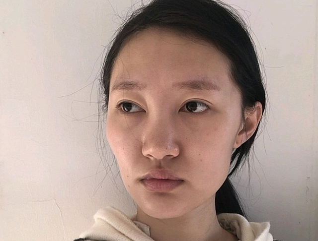 "苦相脸"女生,这些特征很明星!显丑还显老,自查下你占几个