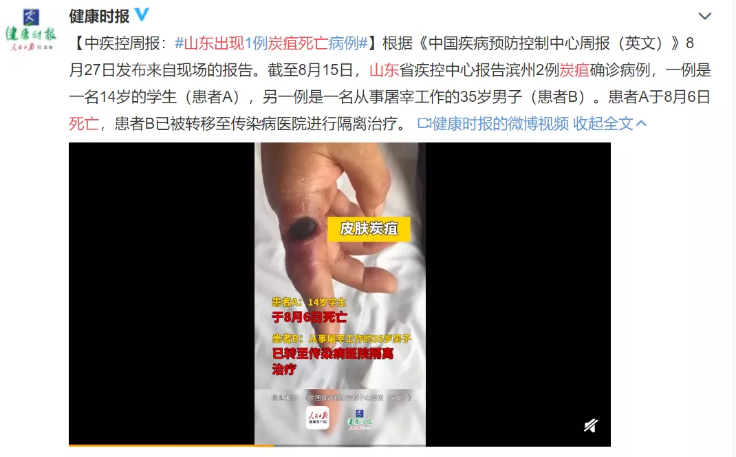 据报道,近期,我国山西,北京和内蒙古等地也相继报告了炭疽疫情.