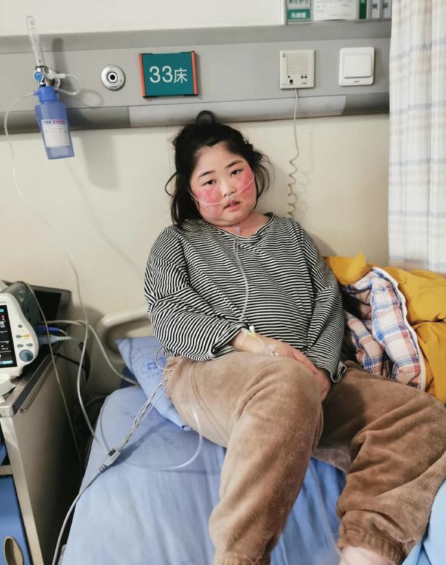 穿古装跳舞胖女孩住院!血小板变少全身出血,医生已下病危通知书