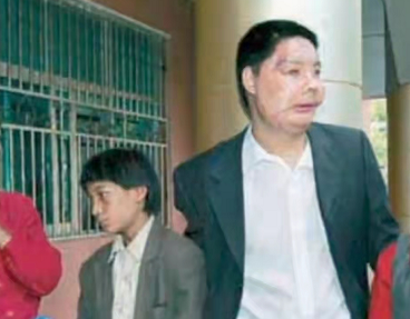 中国换脸第一人李国兴,2006年背60斤西药回家,两年后离奇去世