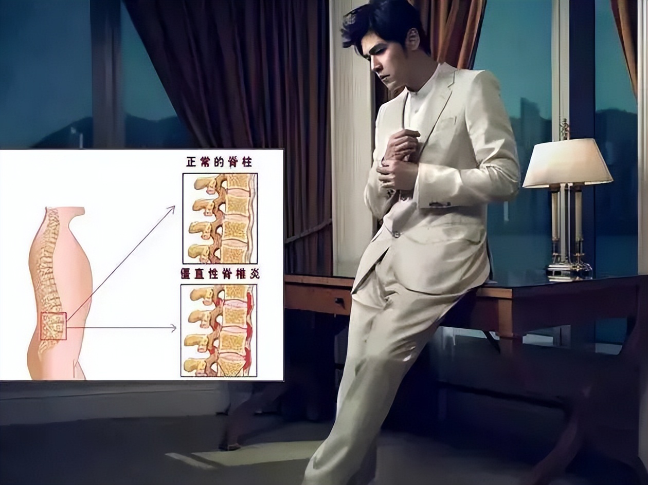 "说到这里,作为医生,不得不提及到曾困扰周杰伦的一